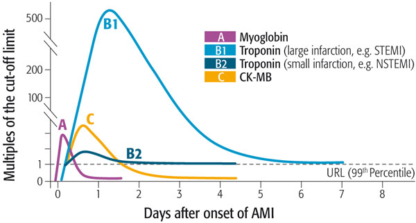 Myo-Die frühesten ungewöhnlich erhöhte kardiale protein marker nach myokard-schädigung